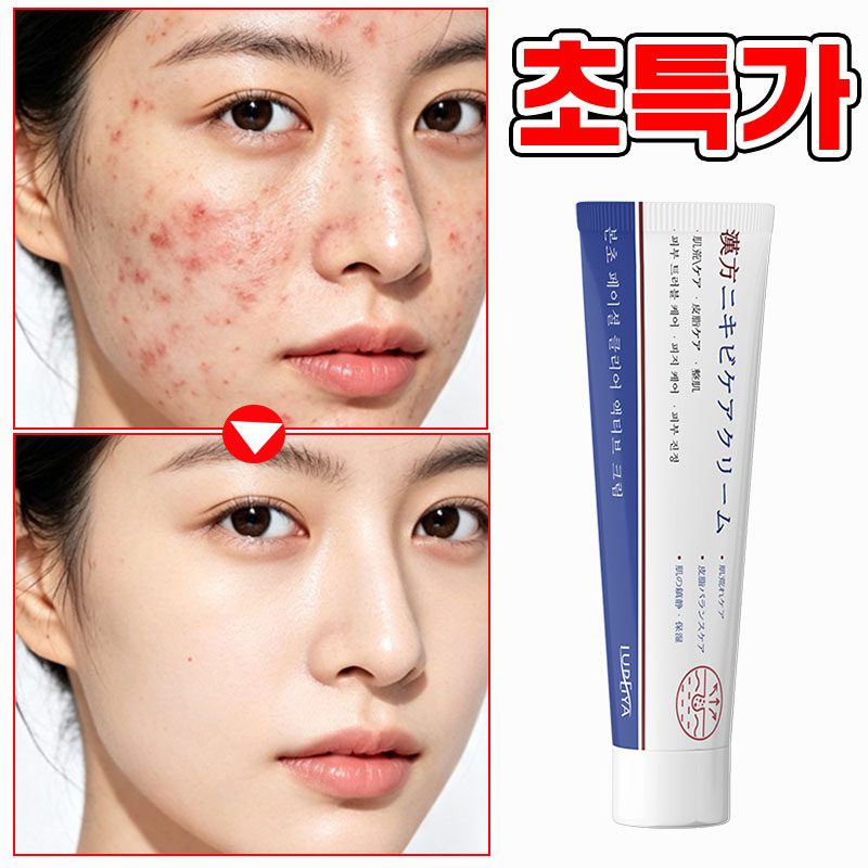 [본토출하] 여드름 흉터 개선 크림 피부재생 크림 청소년 사춘기 피부청결